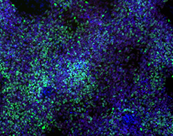 Cerebral Toxicity Studies