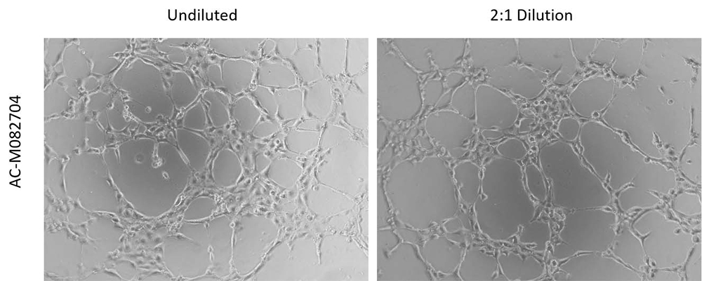 Angiogenesis Assay