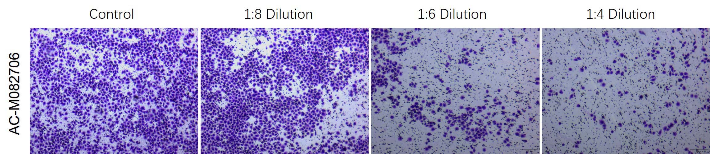  Mogengel TUMOR INVASION ASSAY