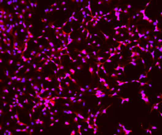  GFAP IMMUNOSTAINING