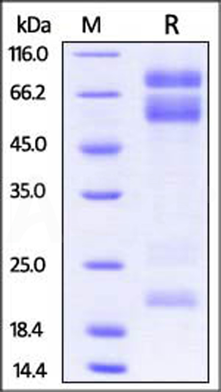 Mouse ADAM17, His Tag (Cat. No. AD7-M52H1) SDS-PAGE gel