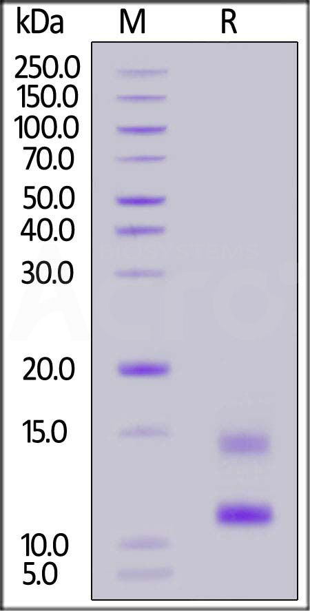 Rabbit BCMA, His Tag (Cat. No. BCA-R52H4) SDS-PAGE gel