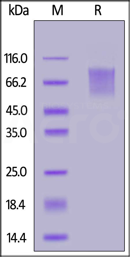 CD30 SDS-PAGE