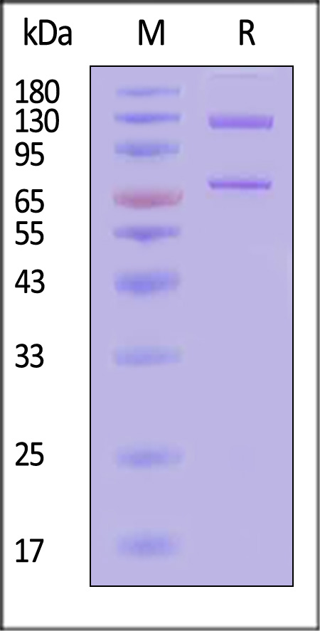 Complement C5 SDS-PAGE