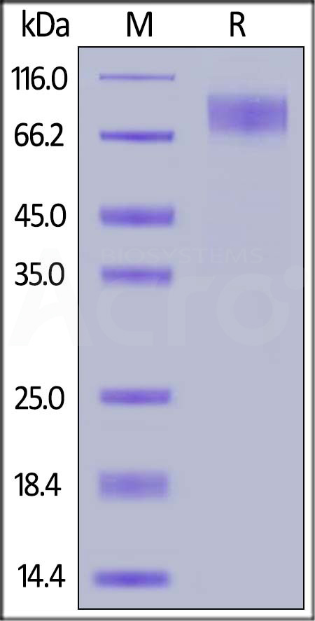 Rabbit M-CSF R, His Tag (Cat. No. CSR-R82H5) SDS-PAGE gel