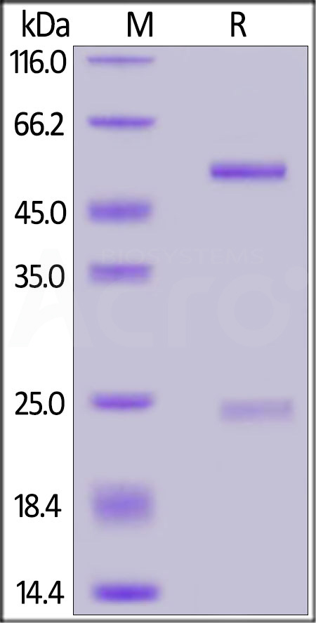 IgG control SDS-PAGE