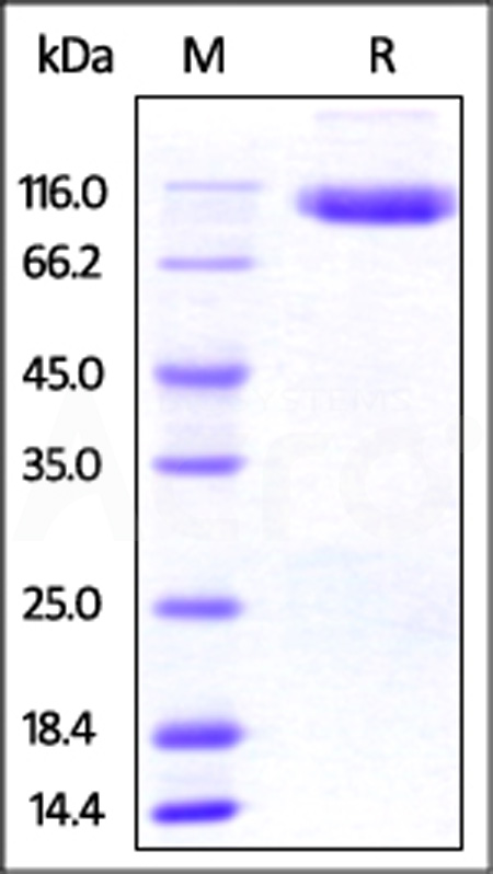 Human DPPIV, His Tag (Cat. No. DP4-H5221) SDS-PAGE gel