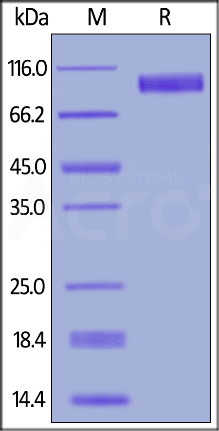 EGF R SDS-PAGE