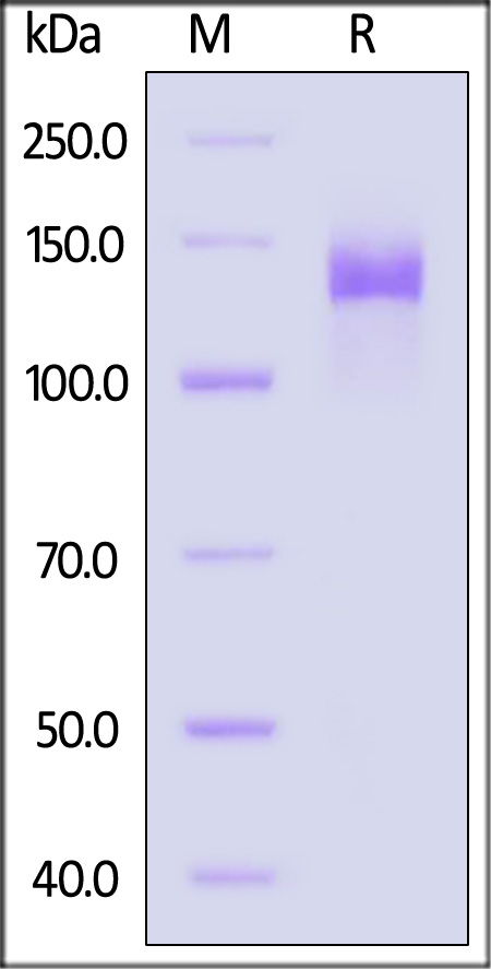 ENPP3 SDS-PAGE