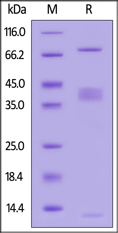 LRRC32 & TGF-beta 1 SDS-PAGE