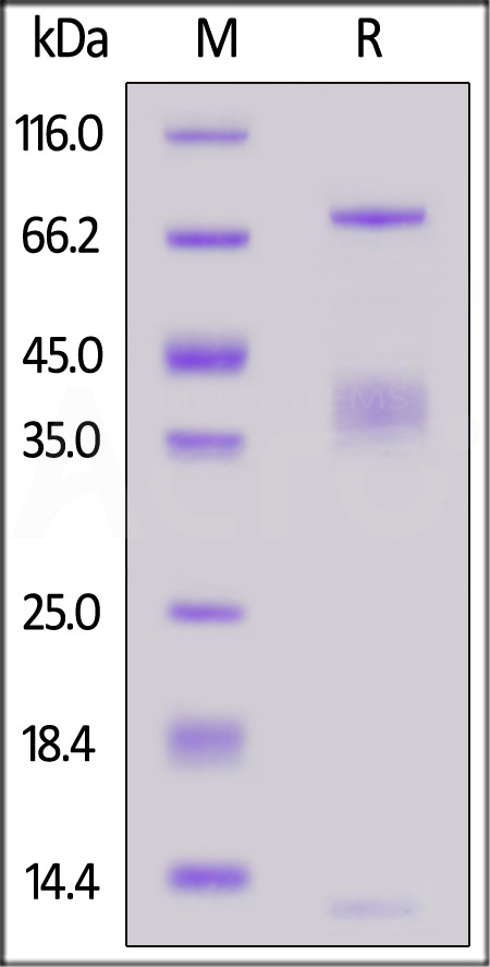 LRRC32 & TGF-beta 1 SDS-PAGE