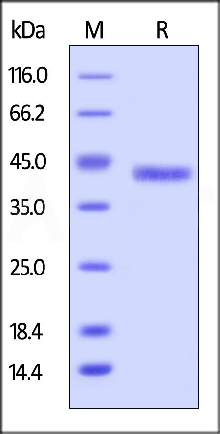 Human Galectin-4, His Tag (Cat. No. GA4-H5246) SDS-PAGE gel