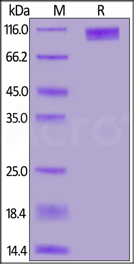 GUCY2C SDS-PAGE