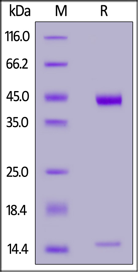 HLA-A*02:01 & B2M & NY-ESO-1 SDS-PAGE