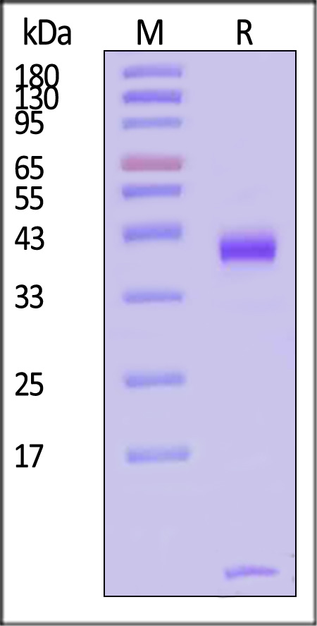 HLA-A*1101 & B2M & KRASG12A (VVVGAAGVGK) SDS-PAGE