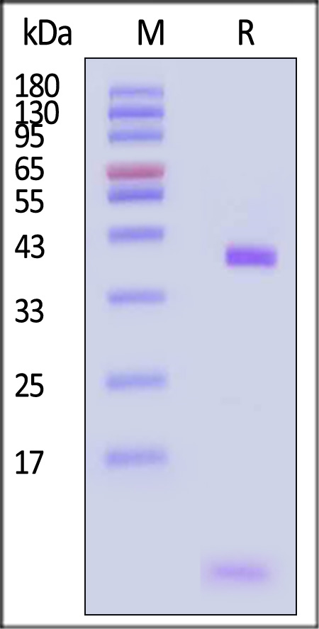 HLA-A*0201 & B2M & Vaccinia virus (ILDDNLYKV) SDS-PAGE