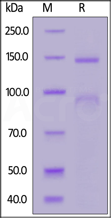 Integrin alpha X beta 2 SDS-PAGE