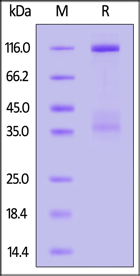 HGF R SDS-PAGE