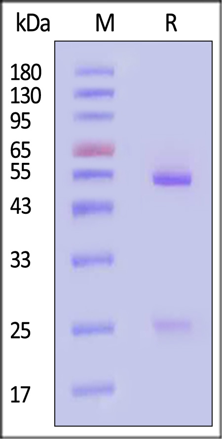 Neuraminidase/NA (Influenza Virus) SDS-PAGE