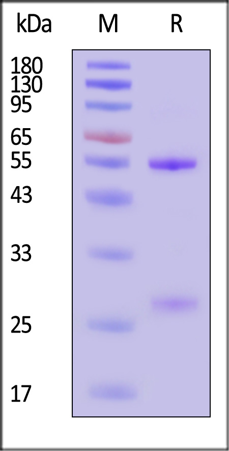 Nipah Post Fusion glycoprotein SDS-PAGE