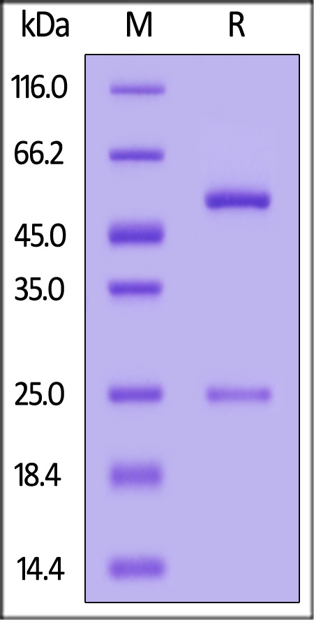 Nucleocapsid protein SDS-PAGE