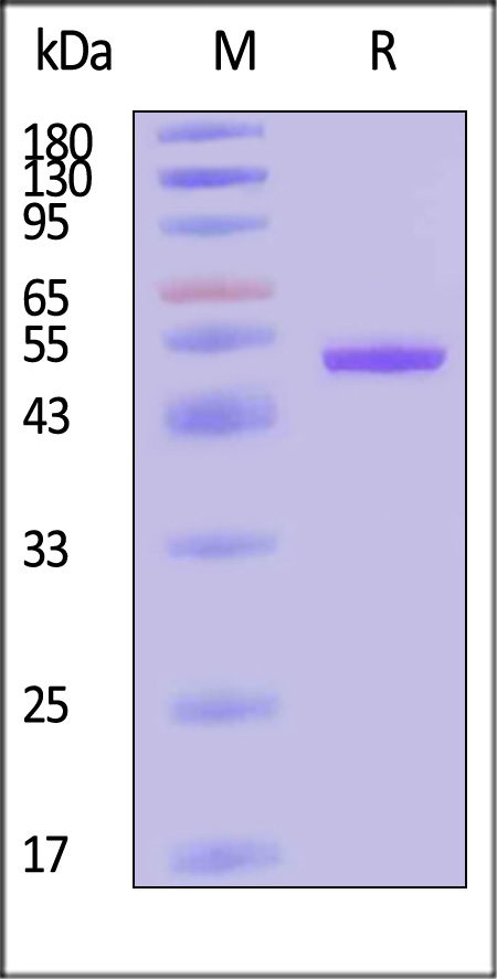 Nucleoprotein (RABV) SDS-PAGE