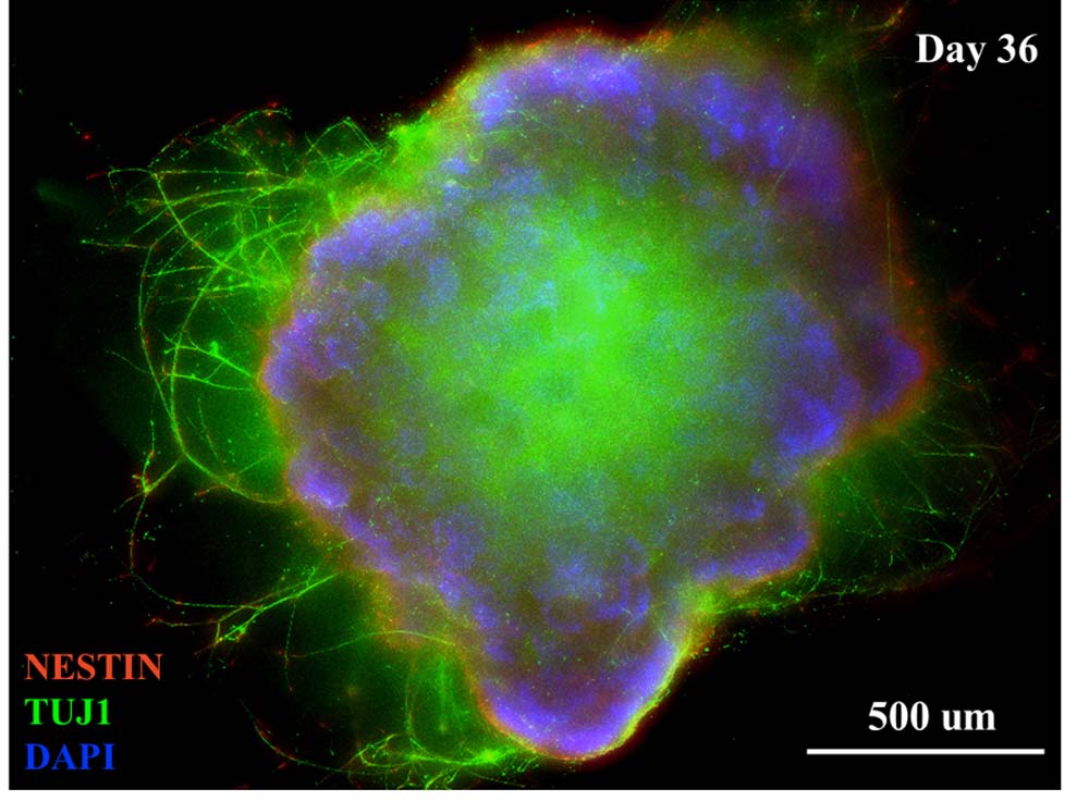  Organoids MARKER EXPRESSION